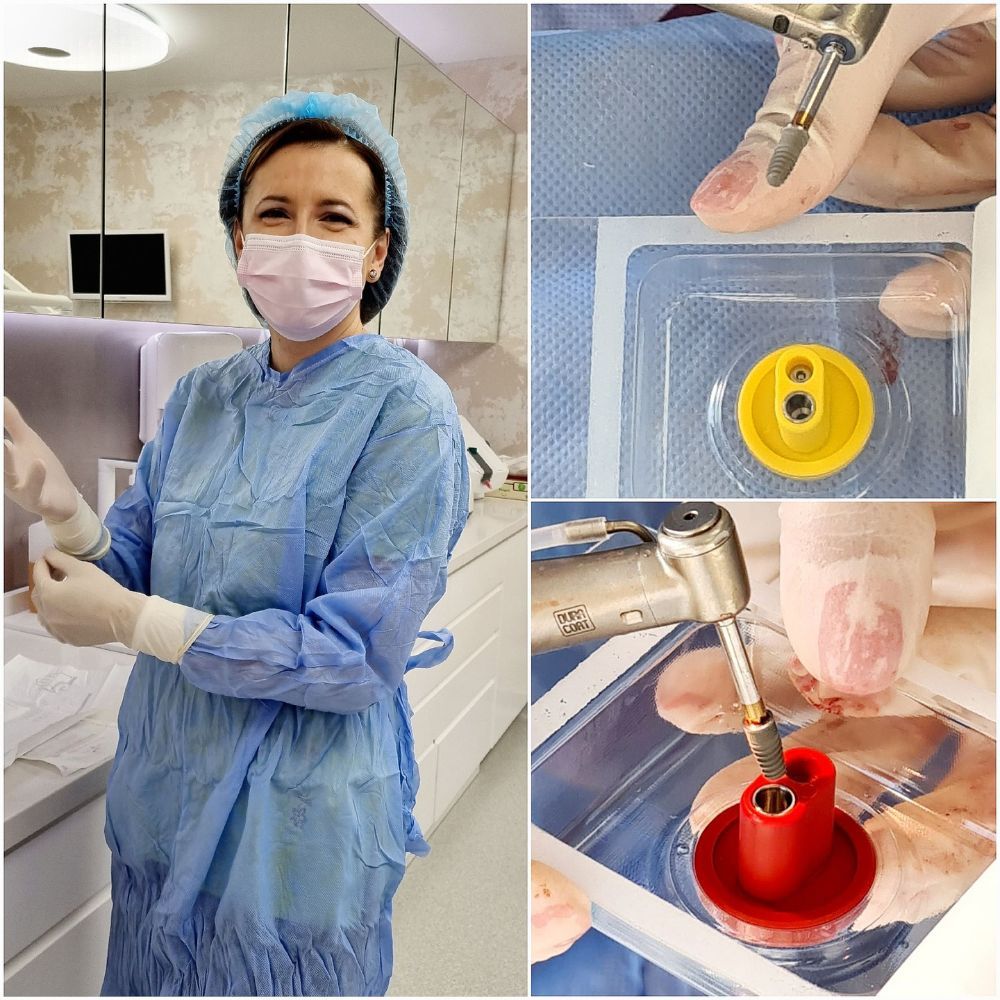 chirurgie+dentara+ogodent01.jpg