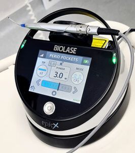 laser_stomatologic_ogodent-266x300.jpg