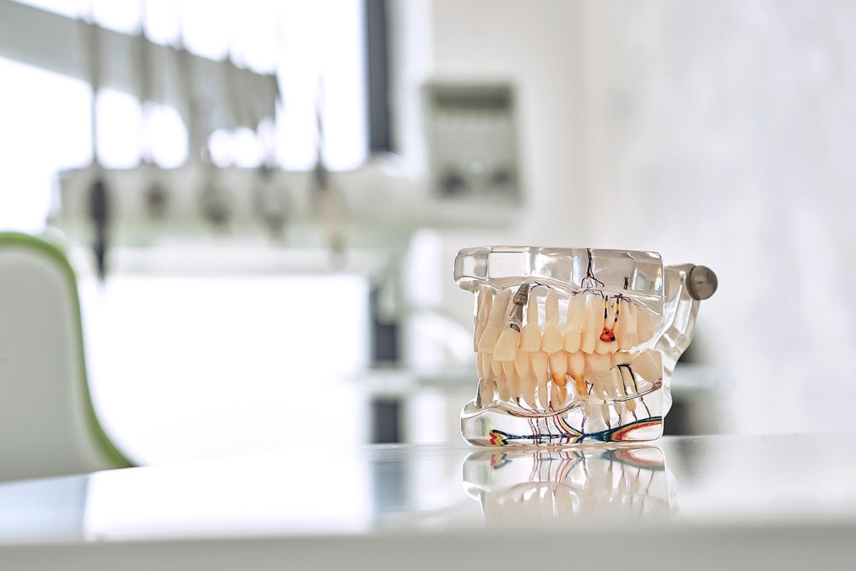 ogodent-implant-dentar.jpg